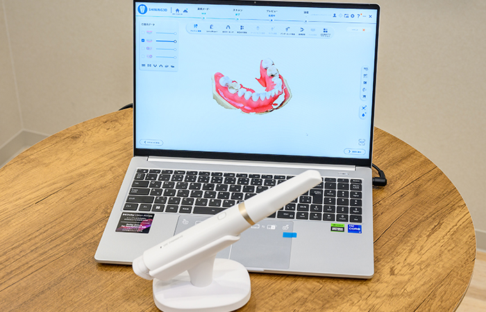 口腔内3Dスキャナー